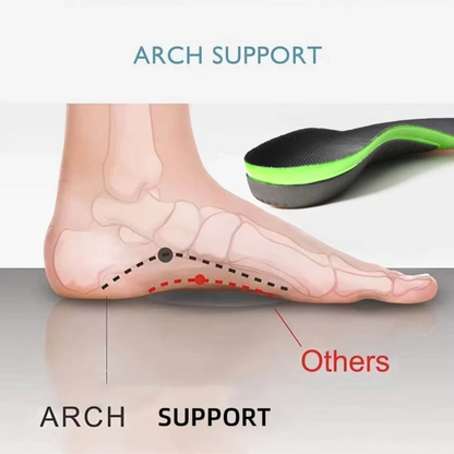 FlexArch™ Support Insoles